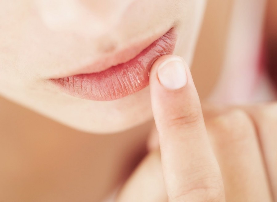 ​Обветренные губы: лечение