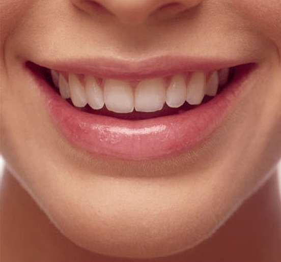 ​Как восстановить потрескавшиеся губы