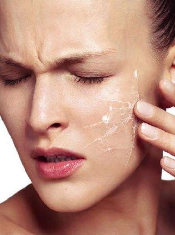 ​Шелушение кожи на лице: причины и лечение