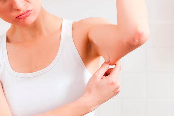 Топ-10 способов подтянуть кожу после похудения
