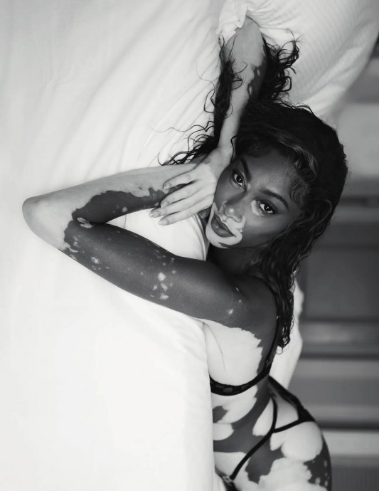 Винни Харлоу (Winnie Harlow) в фотосессии для журнала Vogue Netherlands (2023) Винни Харлоу (Winnie Harlow) в фотосессии для журнала Vogue Netherlands (2023)