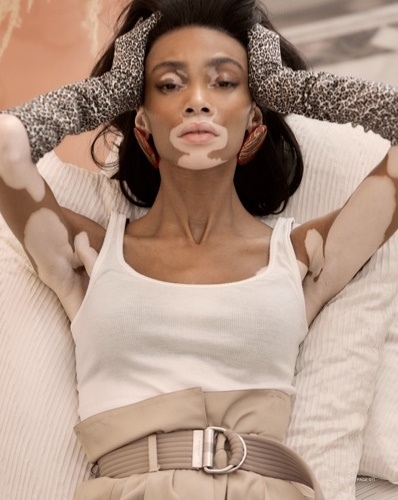 Winnie Harlow for Harper’s Bazaar Taiwan by Harper Smith