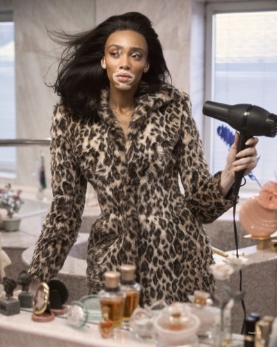 Winnie Harlow for Harper’s Bazaar Taiwan by Harper Smith Winnie Harlow for Harper’s Bazaar Taiwan by Harper Smith