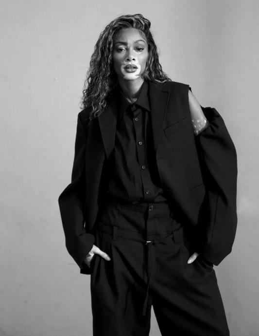 Винни Харлоу (Winnie Harlow) в фотосессии для журнала Vogue Netherlands (2023) Винни Харлоу (Winnie Harlow) в фотосессии для журнала Vogue Netherlands (2023)
