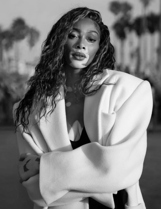 Винни Харлоу (Winnie Harlow) в фотосессии для журнала Vogue Netherlands (2023) Винни Харлоу (Winnie Harlow) в фотосессии для журнала Vogue Netherlands (2023)