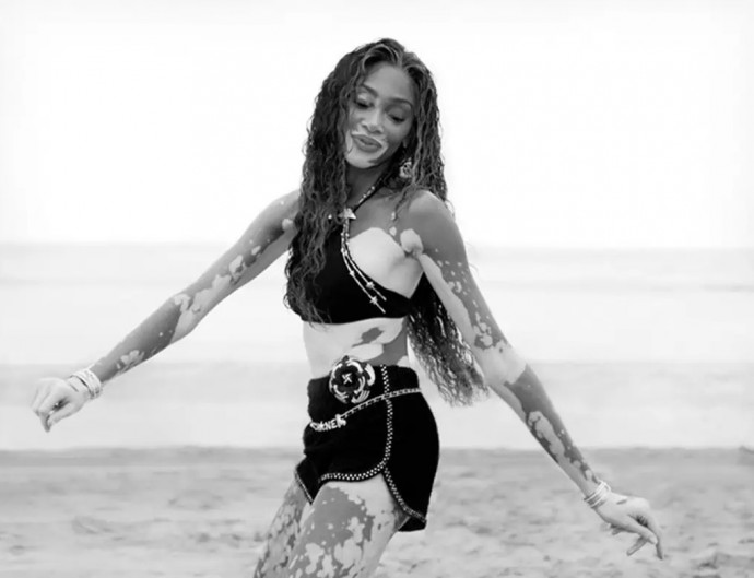 Винни Харлоу (Winnie Harlow) в фотосессии для журнала Vogue Netherlands (2023) Винни Харлоу (Winnie Harlow) в фотосессии для журнала Vogue Netherlands (2023)