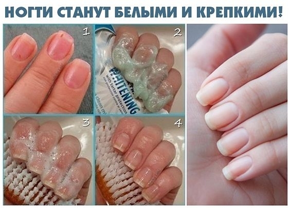 Чтобы ногти всегда выглядели ухоженными и были белыми, длинными и крепкими Чтобы ногти всегда выглядели ухоженными и были белыми, длинными и крепкими